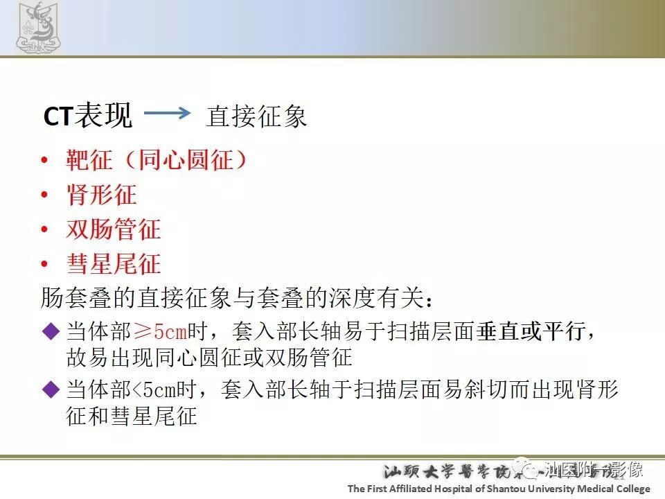 影像PPT - 【PPT】肠套叠影像学诊断-21