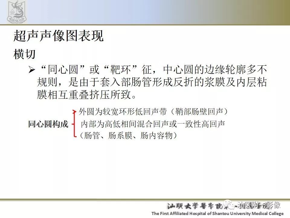 影像PPT - 【PPT】肠套叠影像学诊断-27