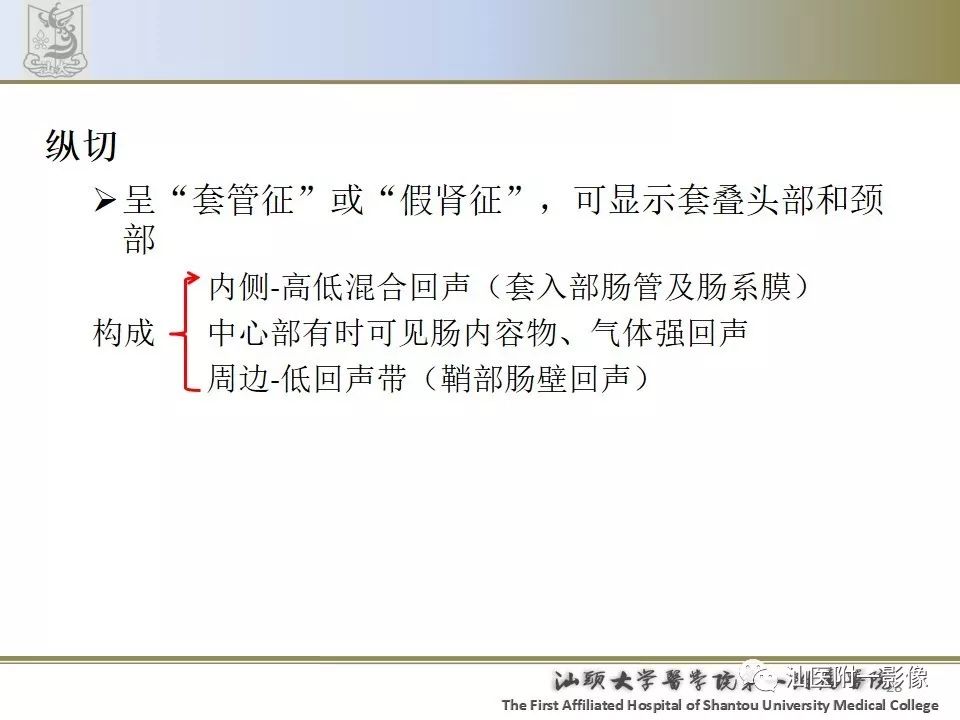 影像PPT - 【PPT】肠套叠影像学诊断-28