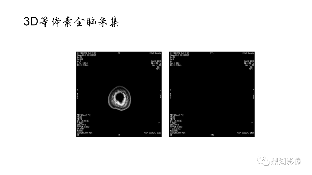 影像PPT - 【PPT】准确识别MR大脑解剖结构的诊断价值-4