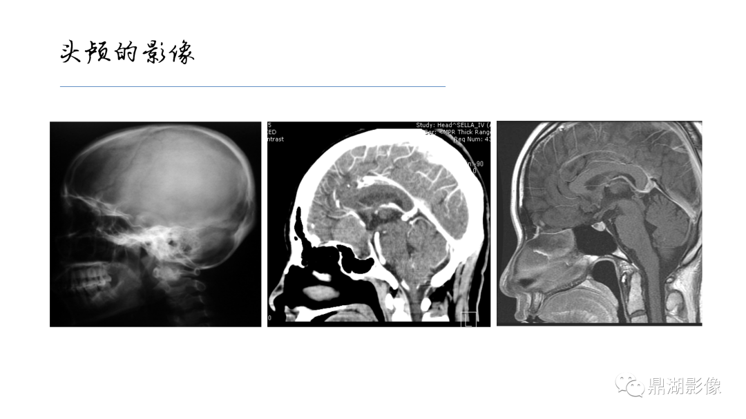 影像PPT - 【PPT】准确识别MR大脑解剖结构的诊断价值-2