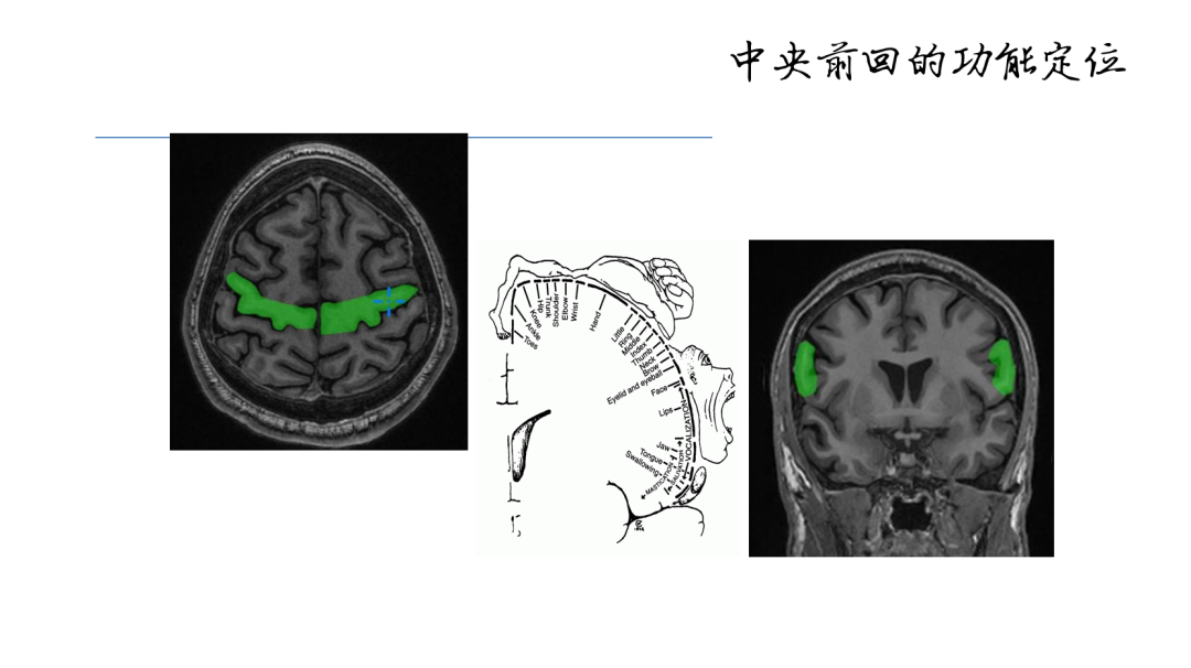 影像PPT - 【PPT】准确识别MR大脑解剖结构的诊断价值-12