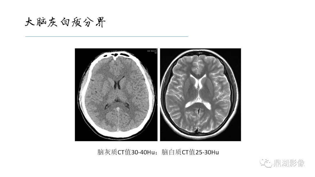 影像PPT - 【PPT】准确识别MR大脑解剖结构的诊断价值-3