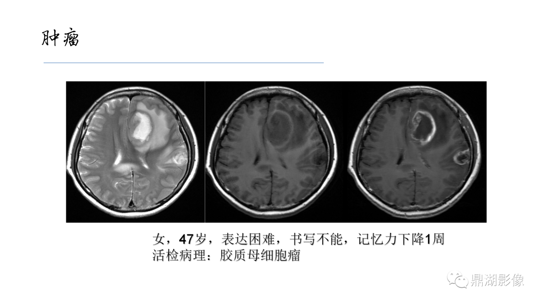 影像PPT - 【PPT】准确识别MR大脑解剖结构的诊断价值-19