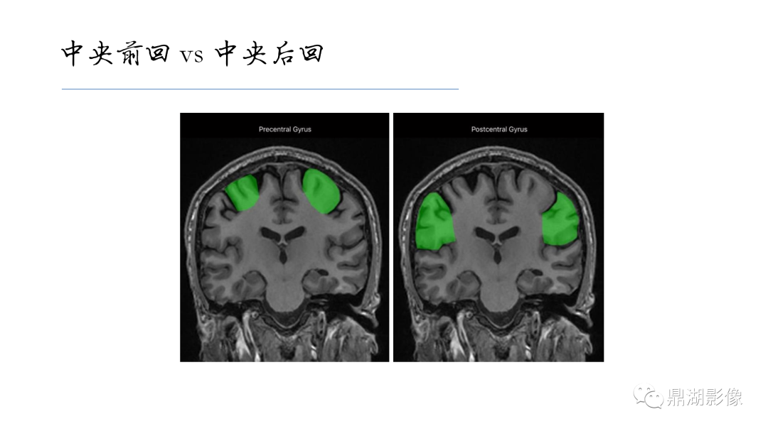 影像PPT - 【PPT】准确识别MR大脑解剖结构的诊断价值-26