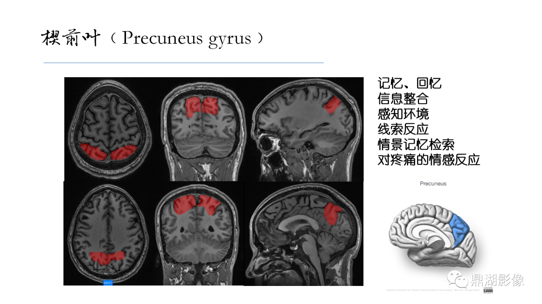 影像PPT - 【PPT】准确识别MR大脑解剖结构的诊断价值-29