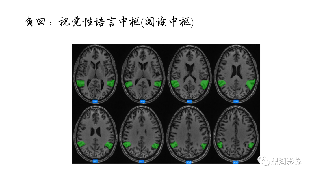 影像PPT - 【PPT】准确识别MR大脑解剖结构的诊断价值-34