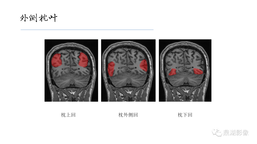 影像PPT - 【PPT】准确识别MR大脑解剖结构的诊断价值-41
