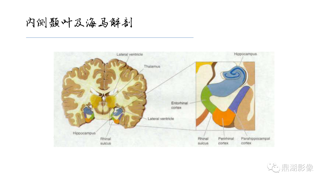 影像PPT - 【PPT】准确识别MR大脑解剖结构的诊断价值-44