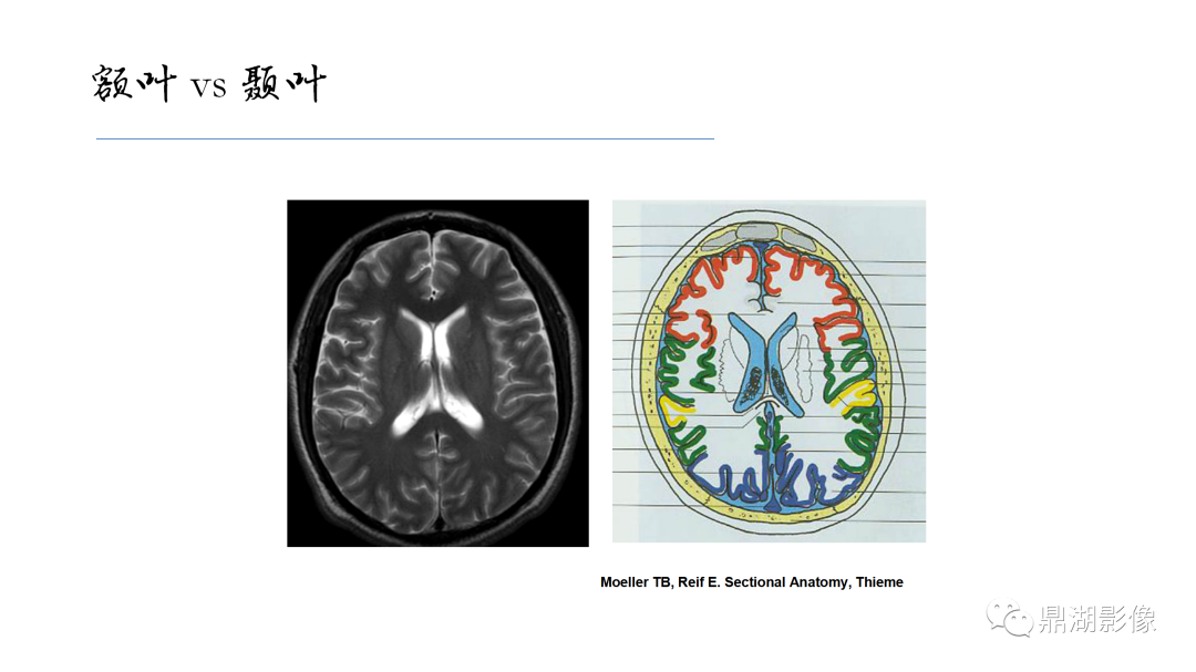 影像PPT - 【PPT】准确识别MR大脑解剖结构的诊断价值-52