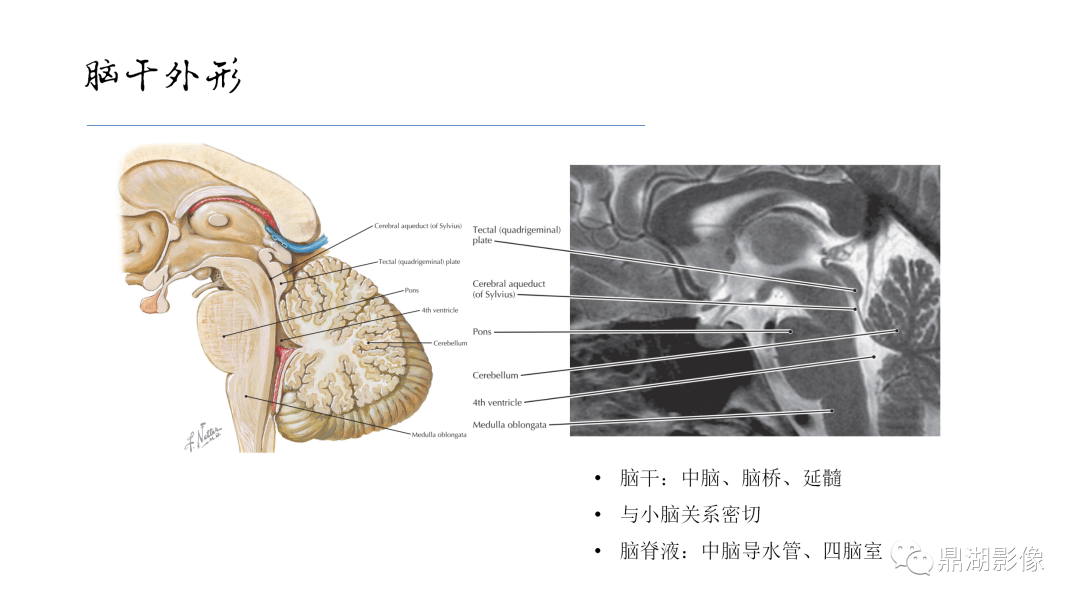 影像PPT - 【PPT】准确识别MR大脑解剖结构的诊断价值-55