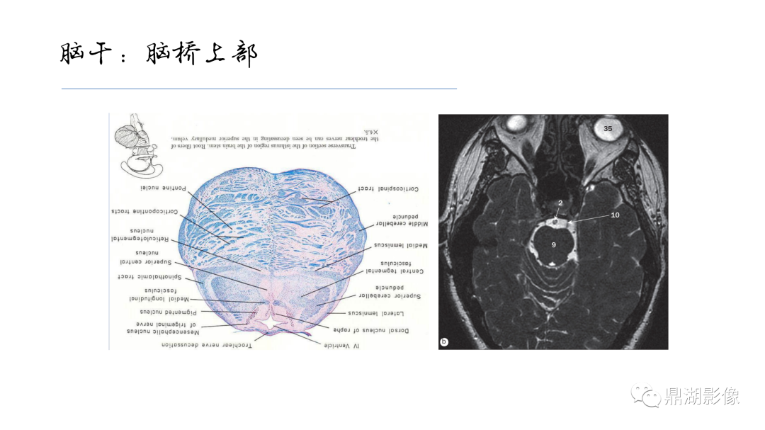 影像PPT - 【PPT】准确识别MR大脑解剖结构的诊断价值-57