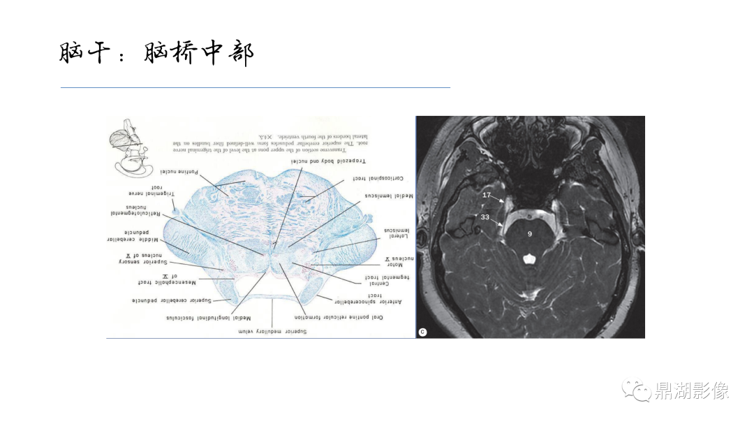 影像PPT - 【PPT】准确识别MR大脑解剖结构的诊断价值-58