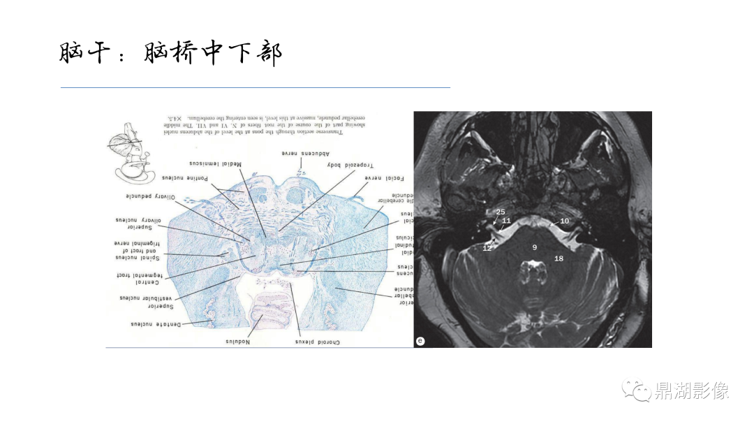 影像PPT - 【PPT】准确识别MR大脑解剖结构的诊断价值-59