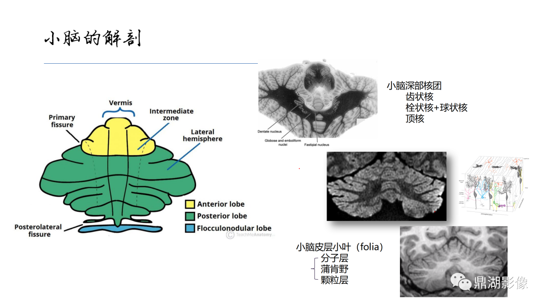 影像PPT - 【PPT】准确识别MR大脑解剖结构的诊断价值-61