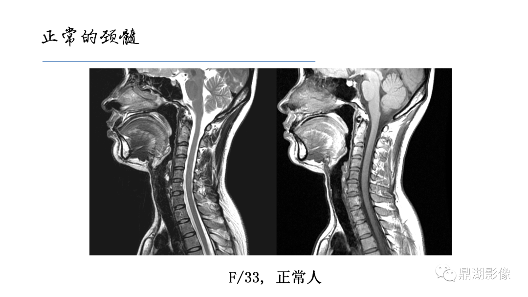 影像PPT - 【PPT】准确识别MR大脑解剖结构的诊断价值-64