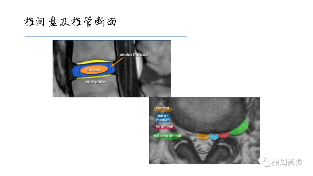 影像PPT - 【PPT】准确识别MR大脑解剖结构的诊断价值-65