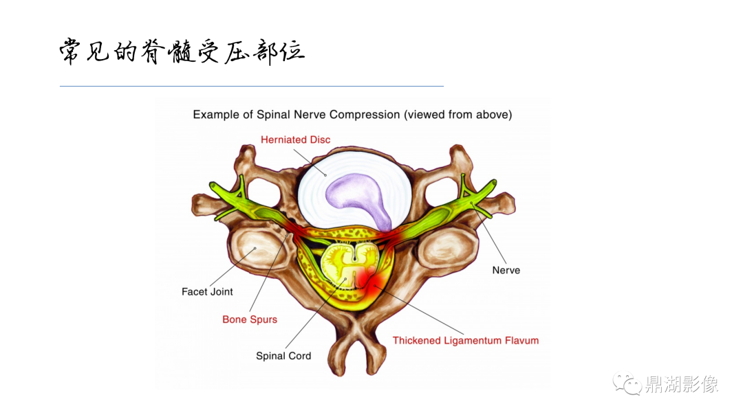 影像PPT - 【PPT】准确识别MR大脑解剖结构的诊断价值-67