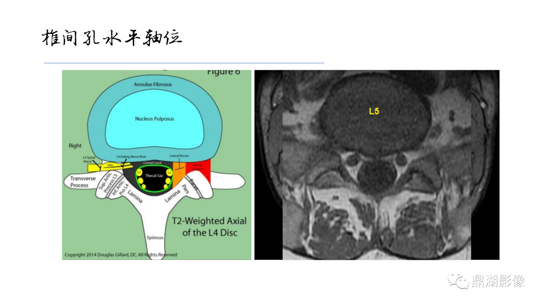 影像PPT - 【PPT】准确识别MR大脑解剖结构的诊断价值-66