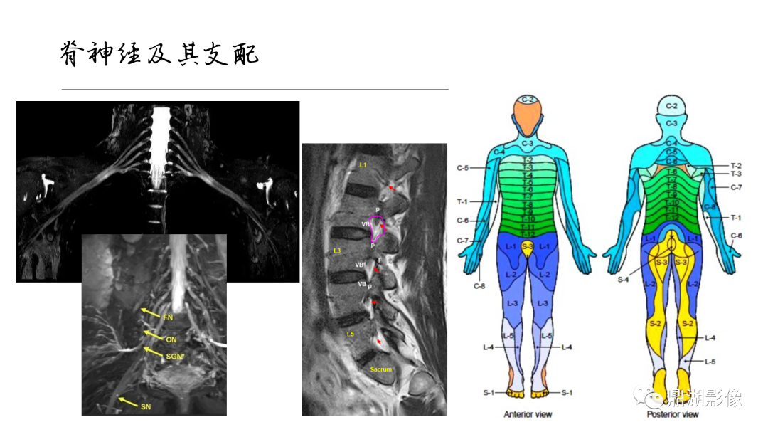 影像PPT - 【PPT】准确识别MR大脑解剖结构的诊断价值-68
