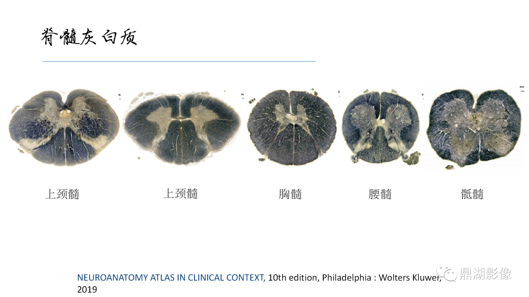 影像PPT - 【PPT】准确识别MR大脑解剖结构的诊断价值-69
