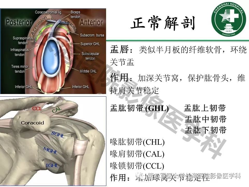 影像PPT - 【PPT】肩关节不稳影像表现-3