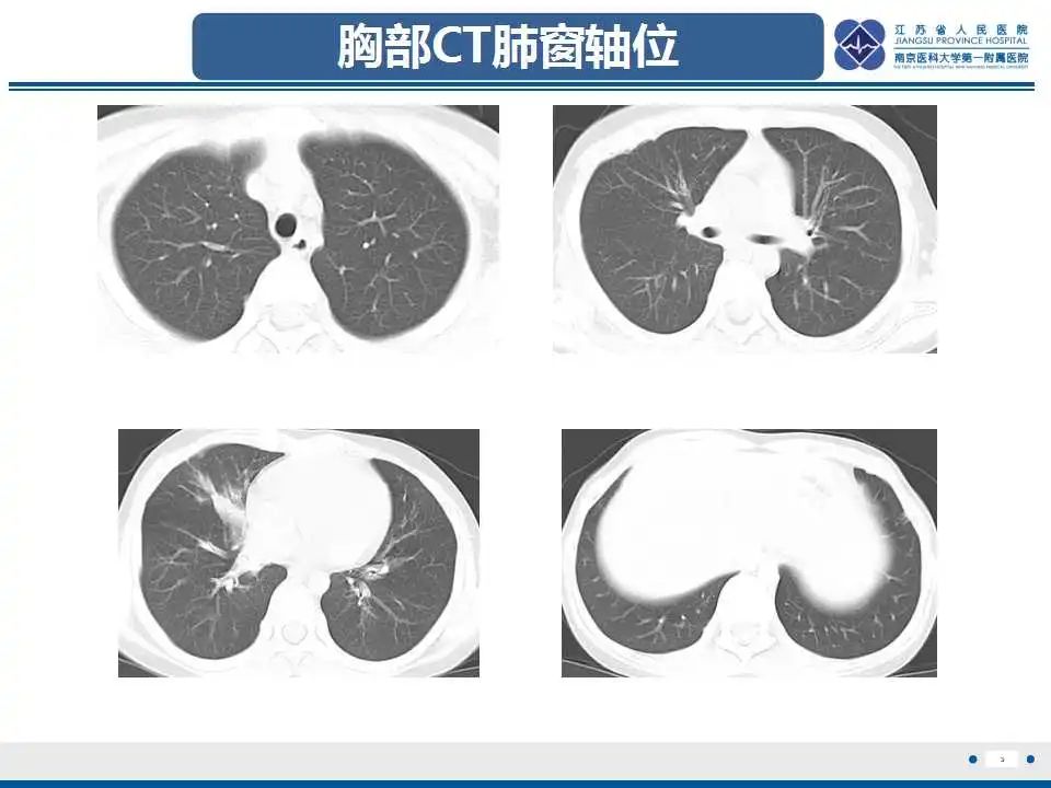 影像PPT - 【PPT】佝偻病-3
