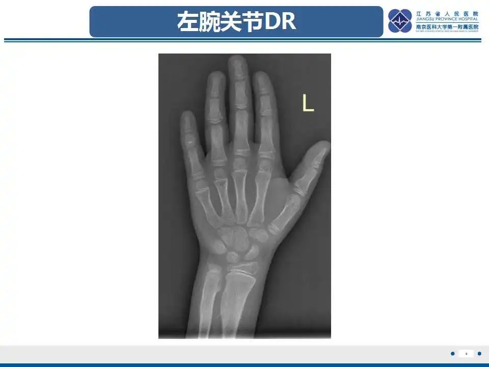 影像PPT - 【PPT】佝偻病-9
