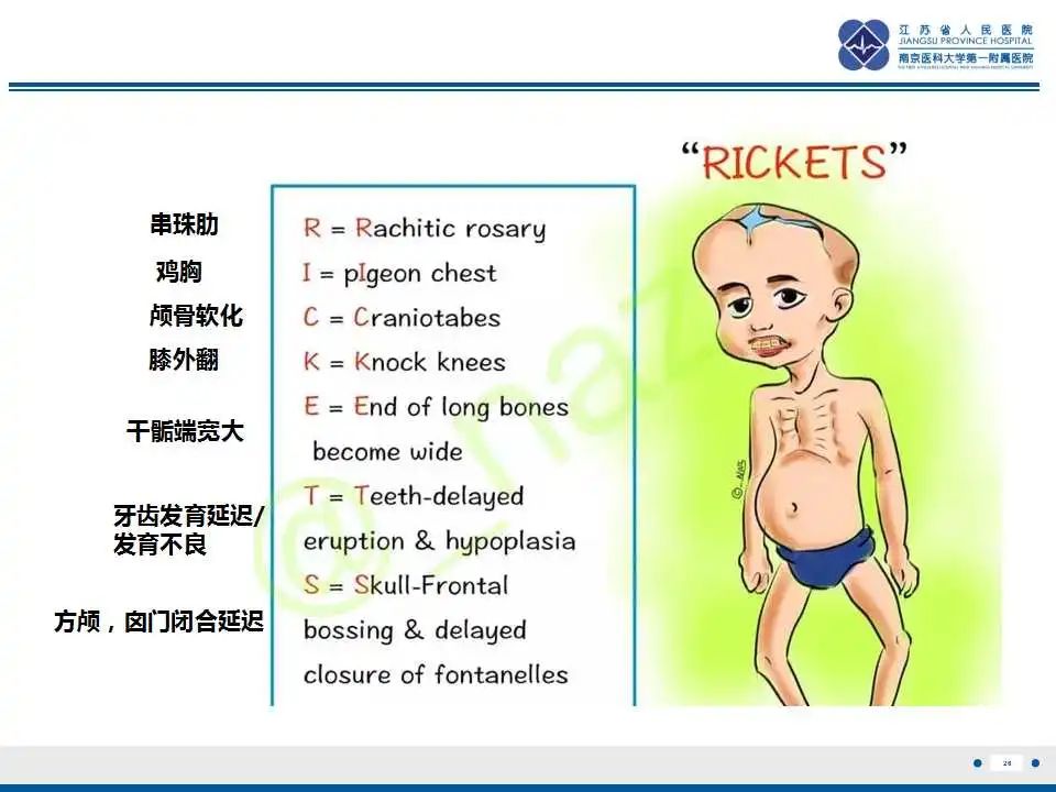 影像PPT - 【PPT】佝偻病-26