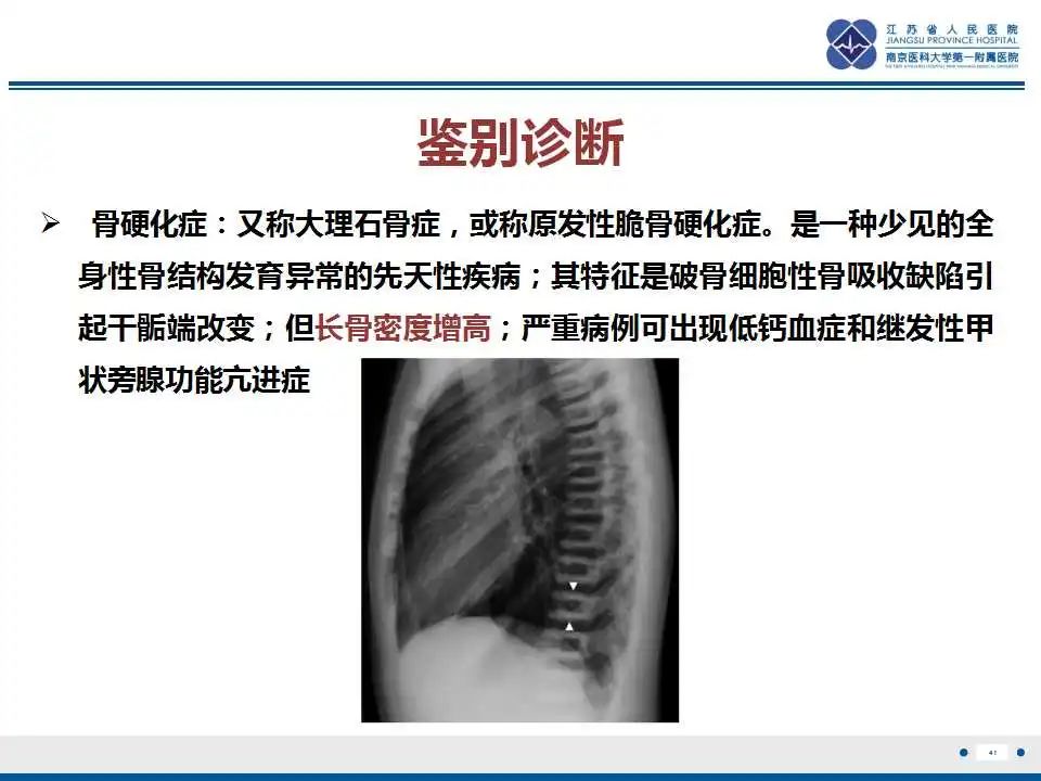 影像PPT - 【PPT】佝偻病-41