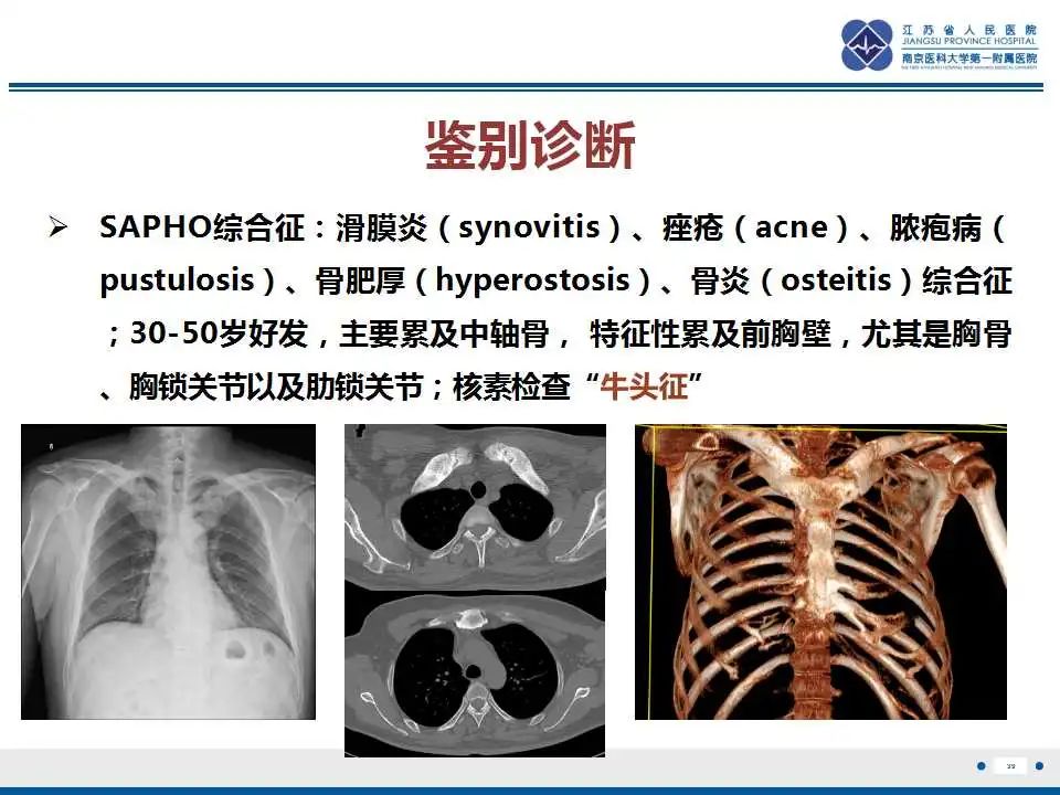 影像PPT - 【PPT】佝偻病-39