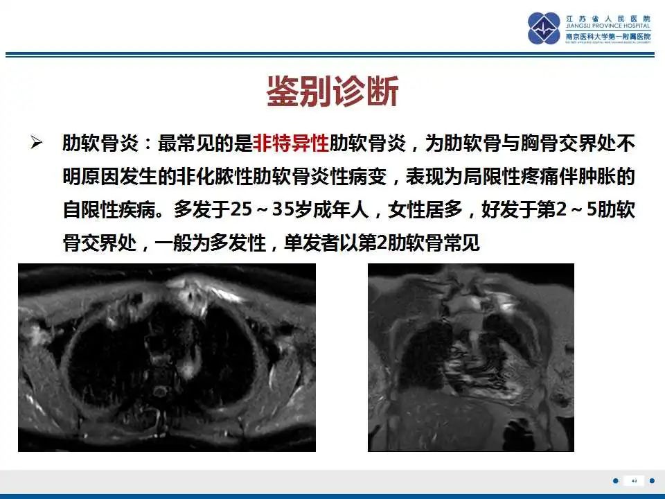 影像PPT - 【PPT】佝偻病-40
