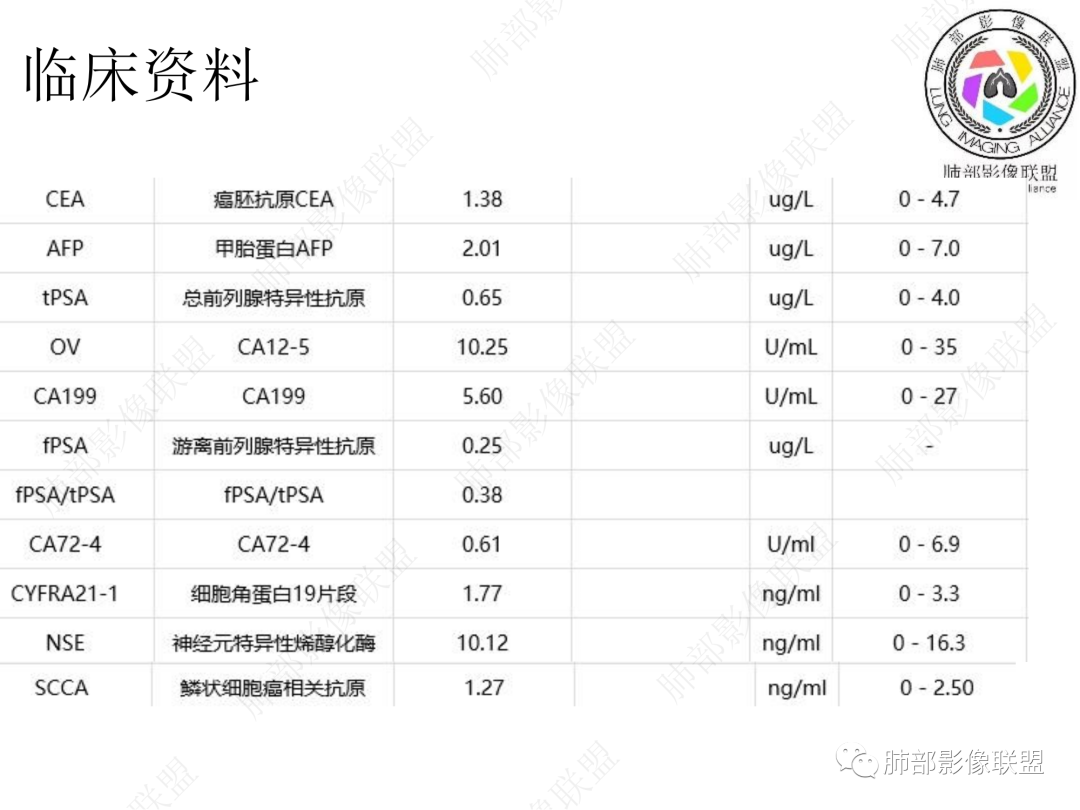 影像PPT - 【病例】年轻男性+环形强化淋巴结一定是结核吗?-3 影像PPT - 【病例】年轻男性+环形强化淋巴结一定是结核吗?-3