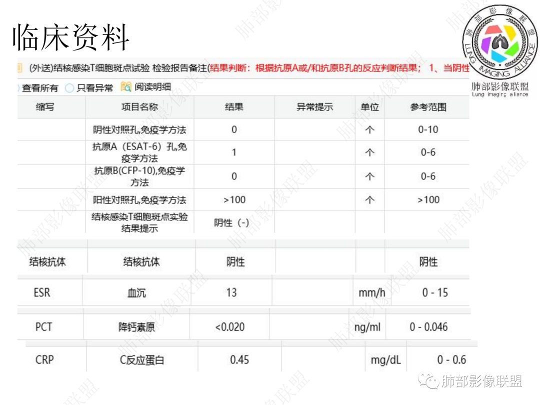影像PPT - 【病例】年轻男性+环形强化淋巴结一定是结核吗?-4 影像PPT - 【病例】年轻男性+环形强化淋巴结一定是结核吗?-4