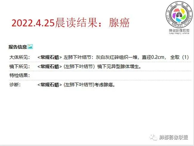 影像PPT - 【病例】年轻男性+环形强化淋巴结一定是结核吗?-24 影像PPT - 【病例】年轻男性+环形强化淋巴结一定是结核吗?-24