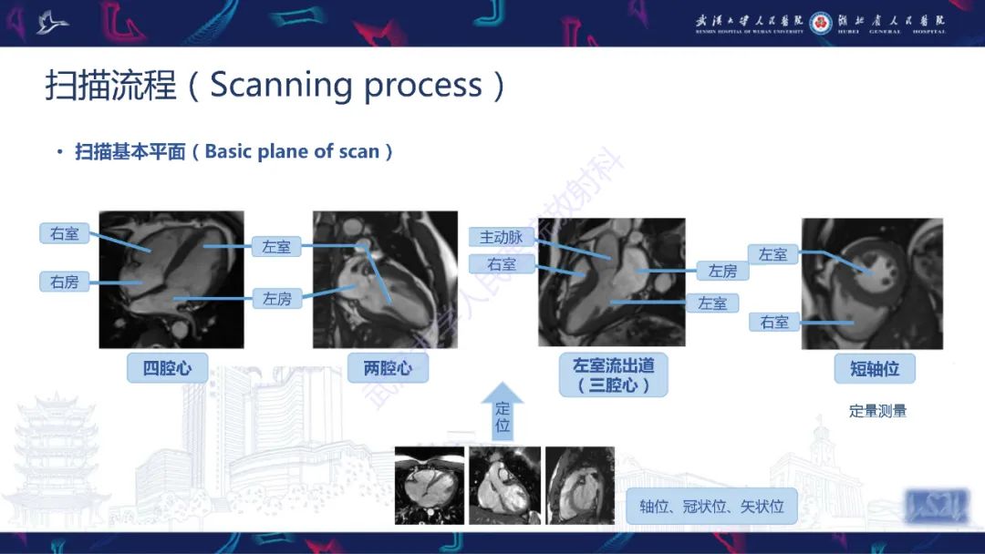 影像PPT - 【PPT】心脏磁共振临床应用-4