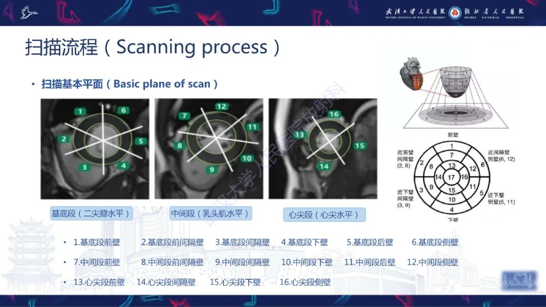 影像PPT - 【PPT】心脏磁共振临床应用-5