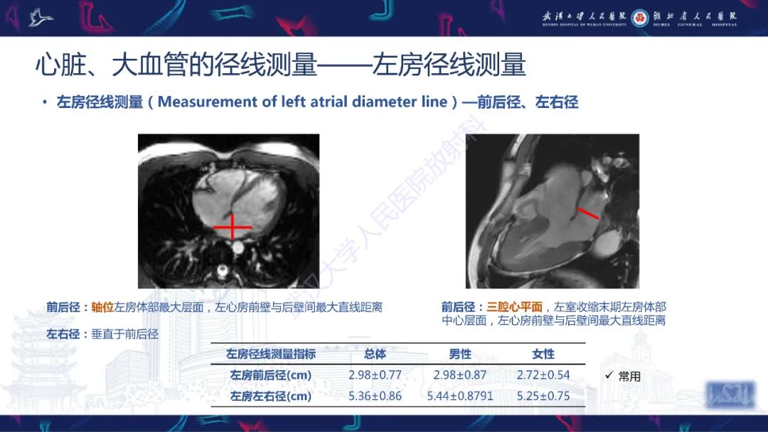 影像PPT - 【PPT】心脏磁共振临床应用-7