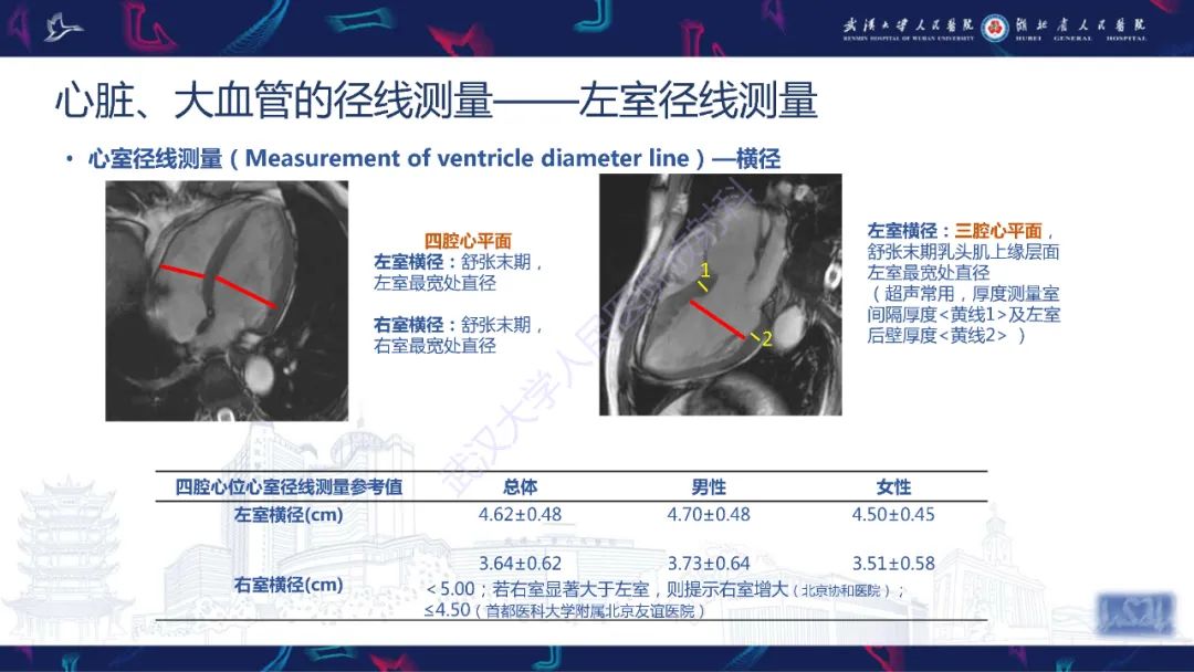 影像PPT - 【PPT】心脏磁共振临床应用-11