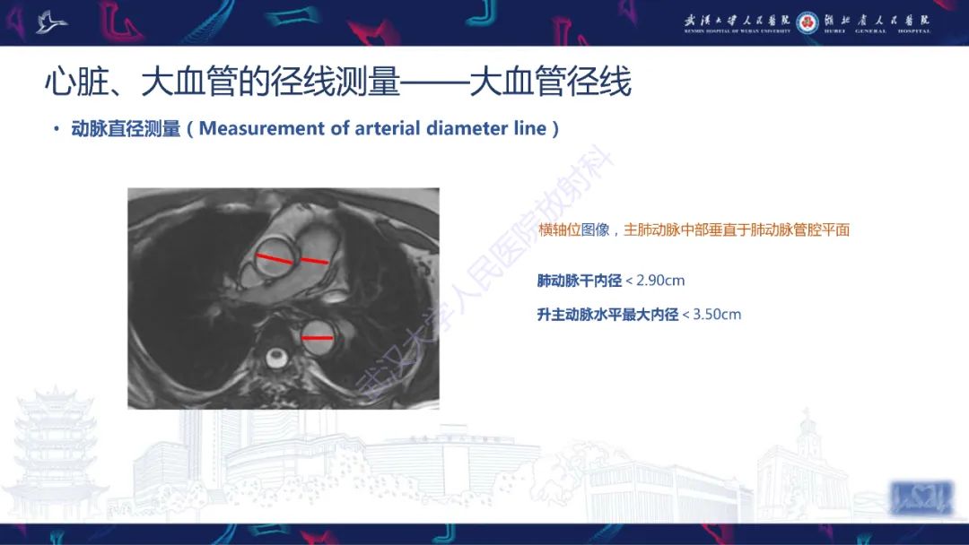 影像PPT - 【PPT】心脏磁共振临床应用-14