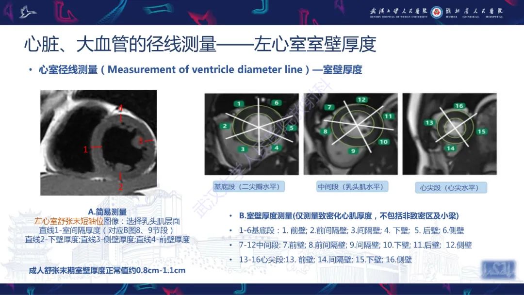 影像PPT - 【PPT】心脏磁共振临床应用-13