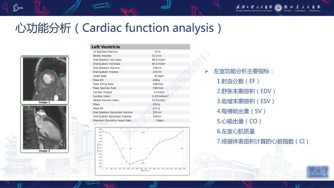 影像PPT - 【PPT】心脏磁共振临床应用-16