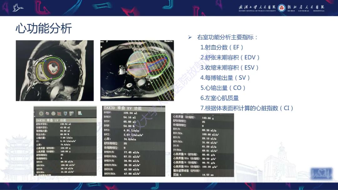 影像PPT - 【PPT】心脏磁共振临床应用-18