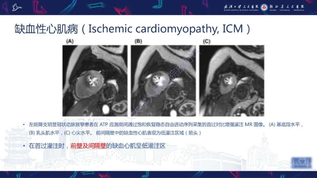 影像PPT - 【PPT】心脏磁共振临床应用-29