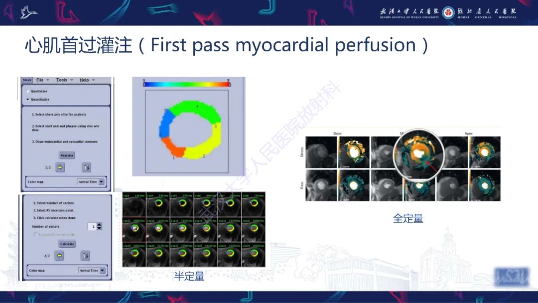 影像PPT - 【PPT】心脏磁共振临床应用-22