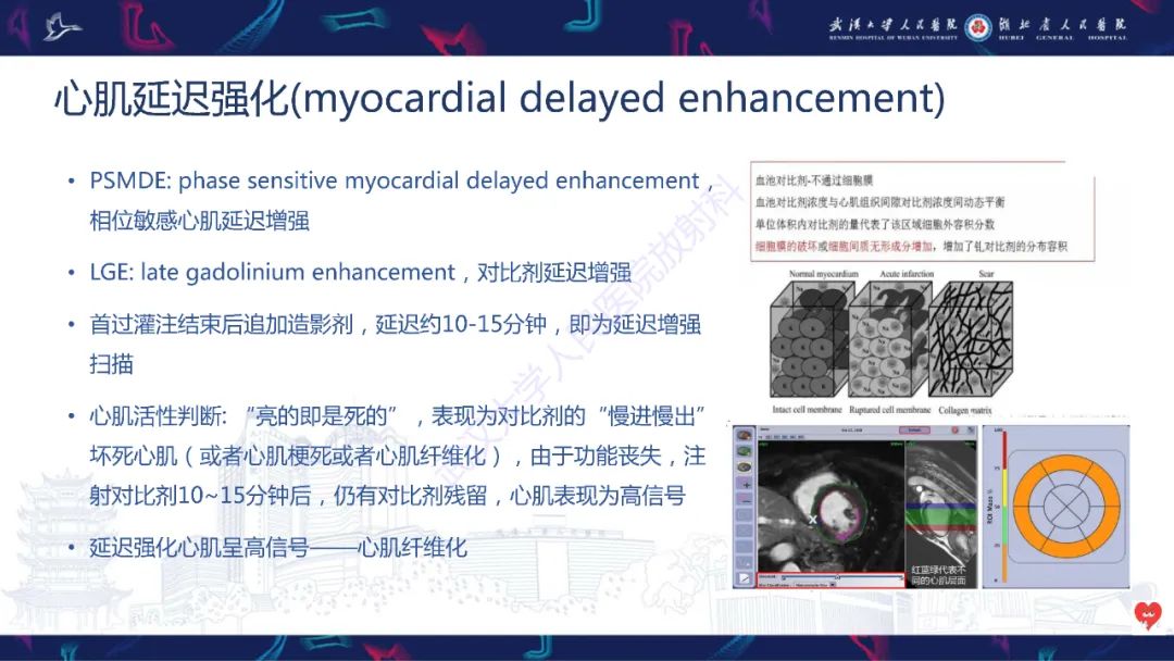 影像PPT - 【PPT】心脏磁共振临床应用-23