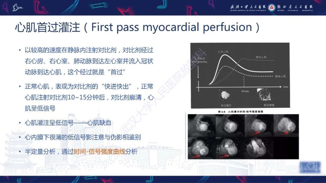 影像PPT - 【PPT】心脏磁共振临床应用-21