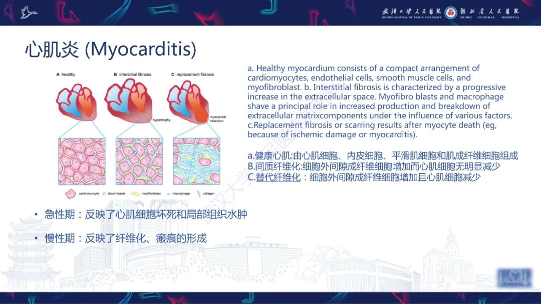 影像PPT - 【PPT】心脏磁共振临床应用-34