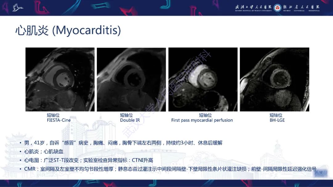 影像PPT - 【PPT】心脏磁共振临床应用-37