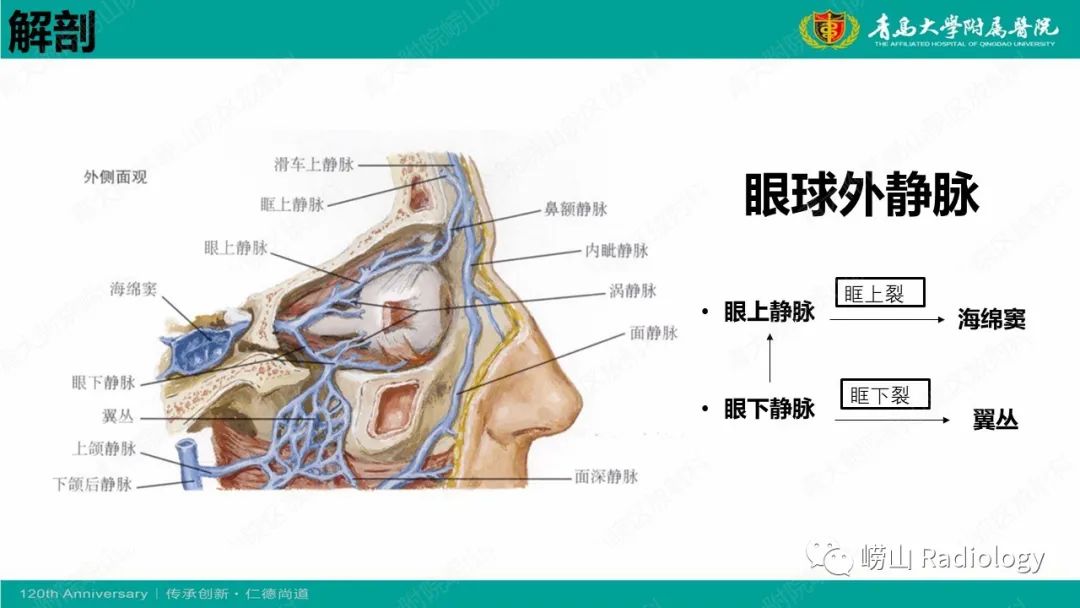 影像PPT - 【PPT】眼眶静脉曲张-4